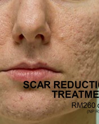 Scar Reduction Treatment
