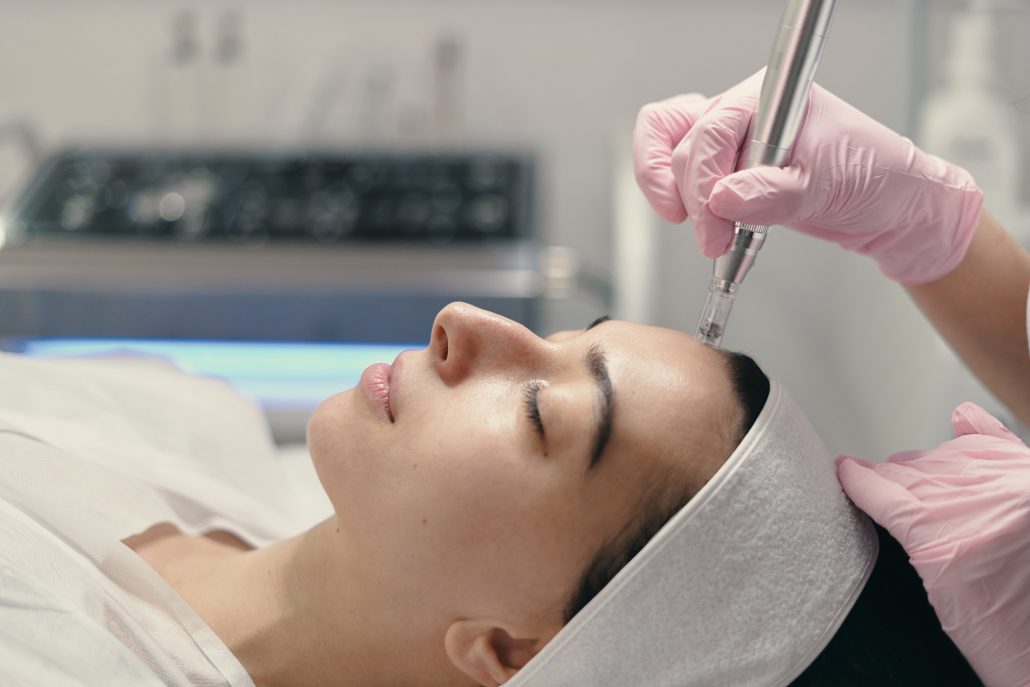 Microneedling Treatment : Safe Acne Scar Removal | Tini's Spa